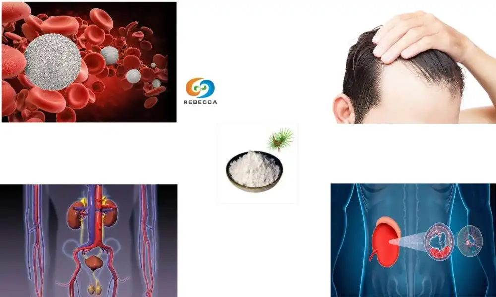 What is saw palmetto berry extract used for?